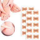 Adesivo Corretor De Unha Encravada