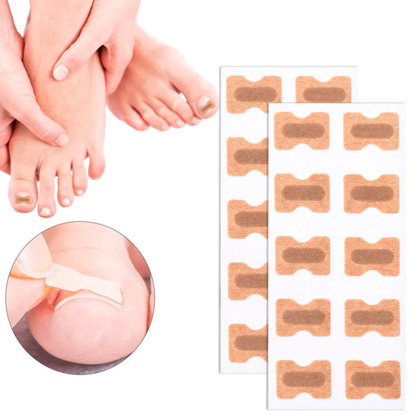 Adesivo Corretor De Unha Encravada